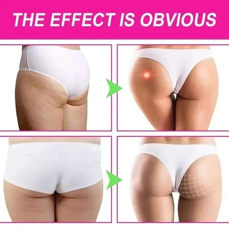힙 탄력 리프팅 크림 피부 탄력 개선 힙 조직 강화 영 - Lifted Nutrition & Fitness Reviews 리뷰 및 가격
